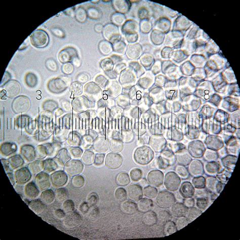 Saccharomyces cerevisiae pod mikroskopom