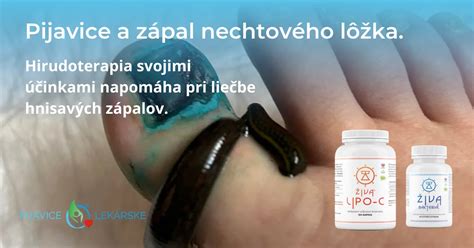Anatómia pijavice lekárskej