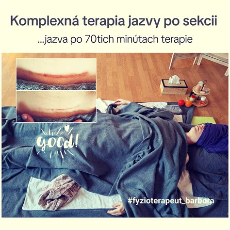Techniky rezu Kerrie japonice