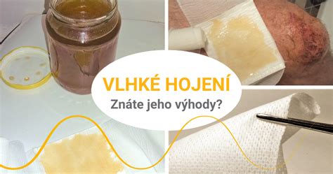 Vlhké hojenie rany