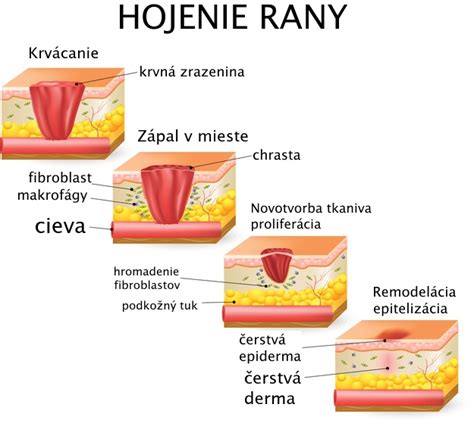 Ilustrácia znázorňujúca proces transformácie a hojenia