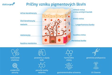 Príčiny vzniku praskajúcich cievok na tvári
