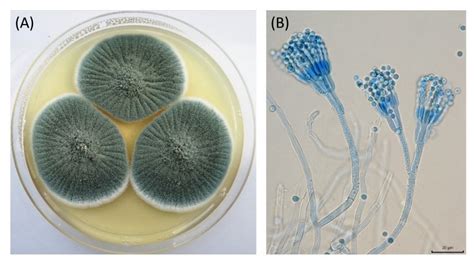 Zblízka Penicillium plesne s konídiami