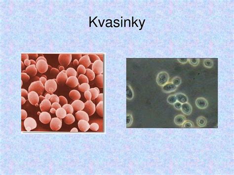 Využitie sóje v potravinárstve a krmivárstve