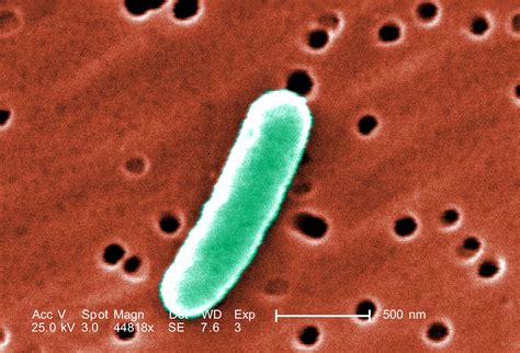 Obrázok baktérie Escherichia coli