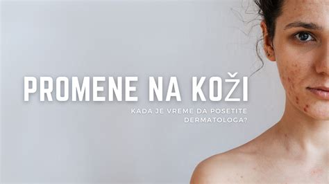 Ilustrácia príznakov ruže na koži