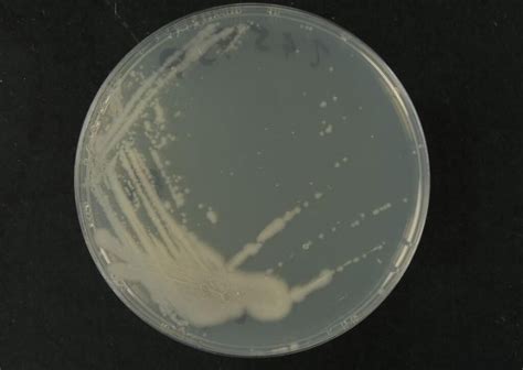 Obrázok baktérie Bacillus mojavensis