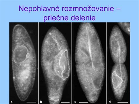 Štruktúra nálevníka a priečne delenie