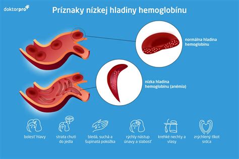 Ukážka zaschnutých končekov listov ako následok nízkej vlhkosti