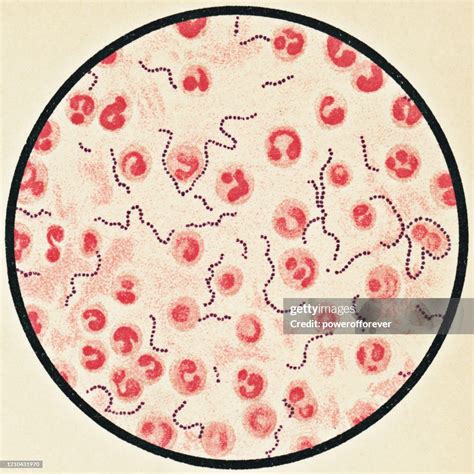 Ilustrácia baktérie Streptococcus pyogenes