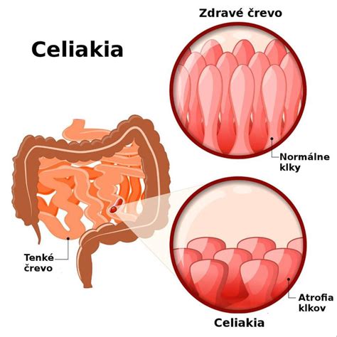 Schematické znázornenie správneho zalievania cyklámenu