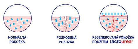 štruktúra suchej pokožky