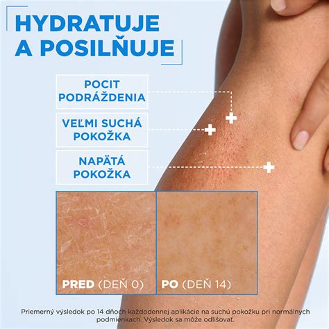 Hydratovaná pokožka