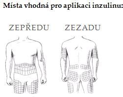 Ilustrácia odporúčaných miest vpichu inzulínu