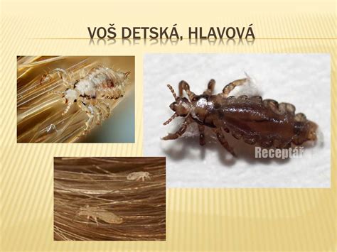 Voš detská - detail