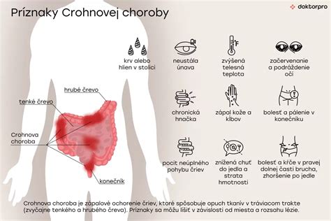 Choroby juky a ich príznaky