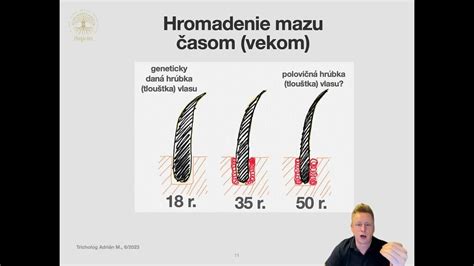 Ilustrácia zdravej a poškodenej vlasovej pokožky