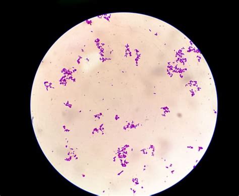 Mikroskopický snímok baktérie Streptococcus pyogenes
