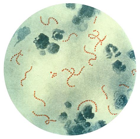 Baktéria Streptococcus pyogenes