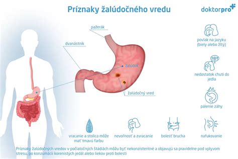 Schéma tráviaceho systému s vyznačením lokalizácie peptického vredu