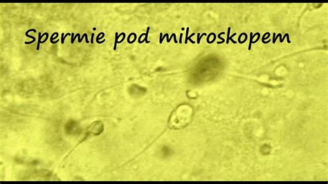 Pohľad na spermie pod mikroskopom