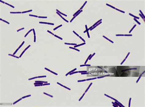 Dve jadrá Bacillus subilis, tvoriace sa priečne septum