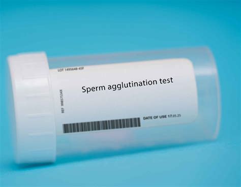 Výsledky spermogramu