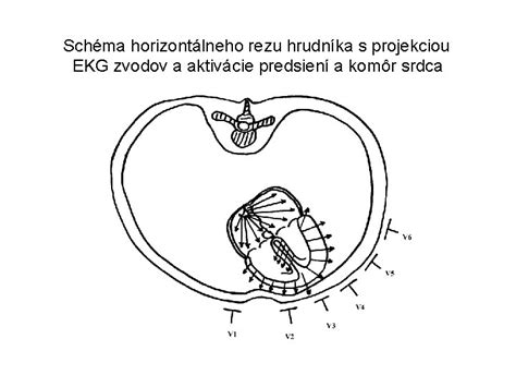 Schéma rezu enciánového stromčeka