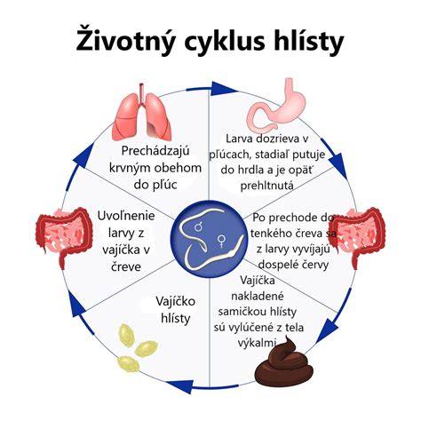 Životný cyklus hlísty detskej