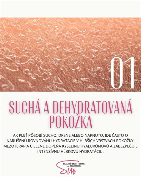 porovnanie hydratácie pokožky pred a po použití telového mlieka