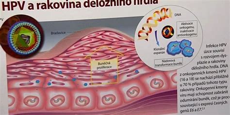 Infografika o očkovaní proti HPV